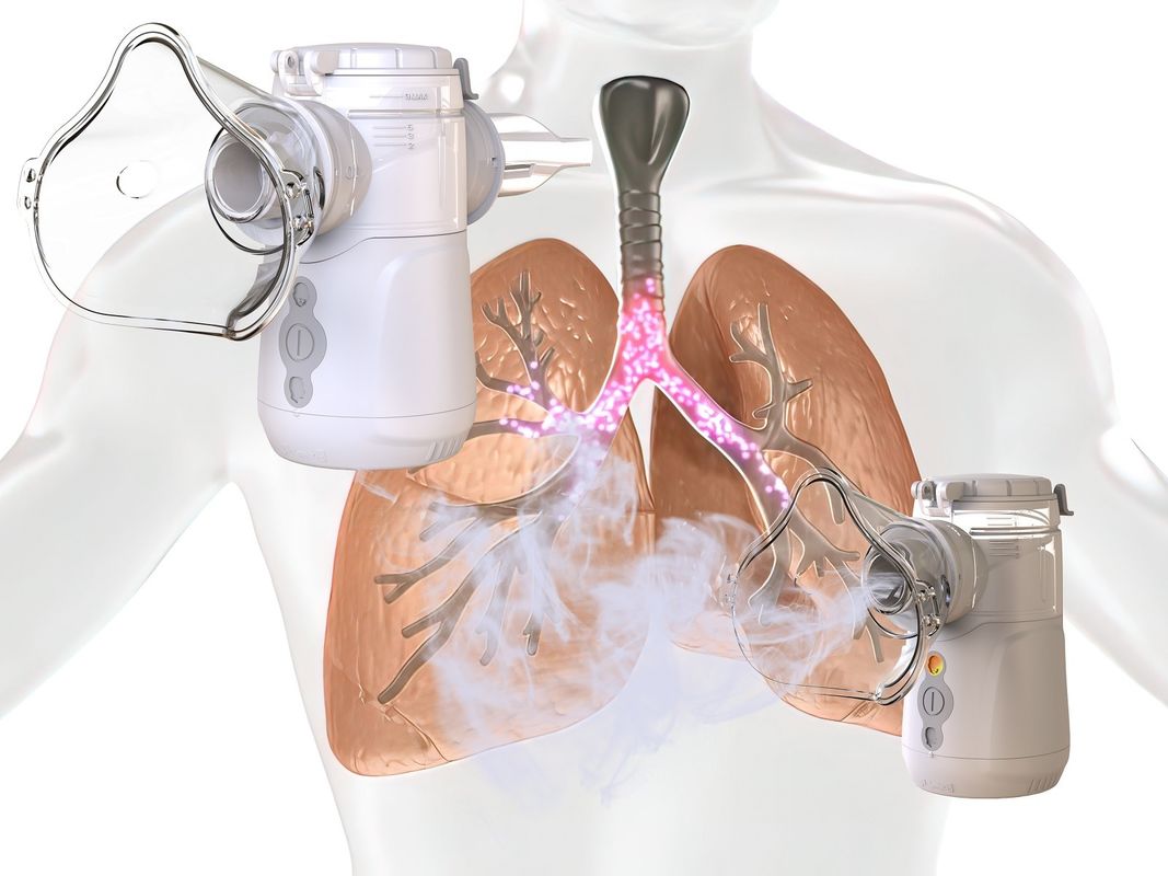 Baterai Inhaler Vibrating Mesh Portable dan DC 5V USB Powered untuk perawatan medis